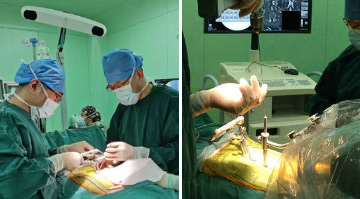 25厘米切口缩小为几个微创“钉眼”！徐州仁慈医院利用骨科手术机器人又完成一例多发腰椎骨折手术