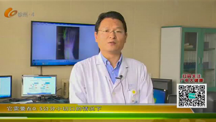 【电视门诊】第三代微创拇外翻矫正技术 有效解除患者足部顽疾