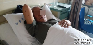 79岁老人患右腹股沟疝10多年，外科李素方主任1.5小时打了3个“小眼”给“补好”了……