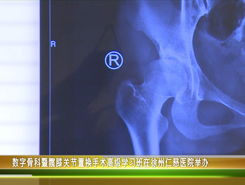 【电视门诊】数字骨科暨髋膝关节置换手术高级学习班在徐州仁慈医院举办