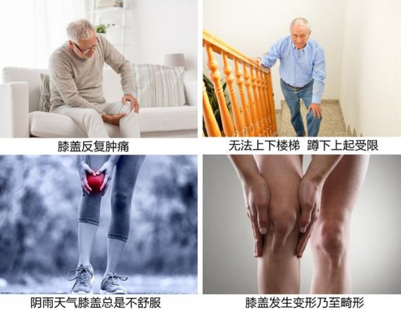 仁慈关节