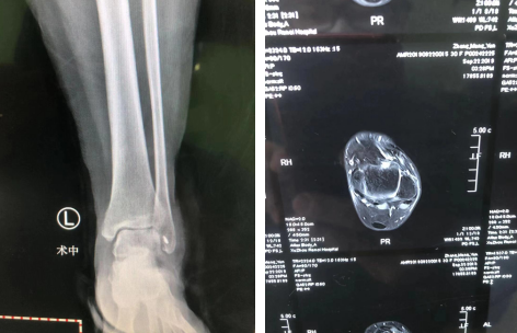 徐州仁慈医院足踝