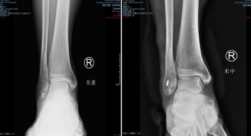 徐州仁慈医院足踝科