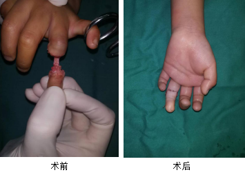 <a href='http://www.xzrcyy.com/' target='_blank'><u>徐州仁慈医院</u></a>手外科