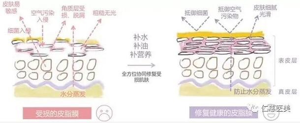皮脂膜受损