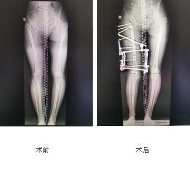 徐州仁慈医院创伤骨科