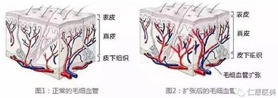 仁慈医美
