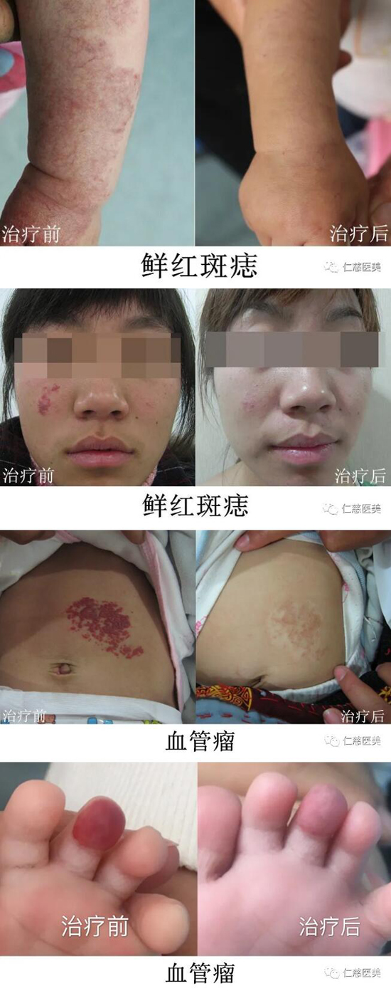 仁慈医美