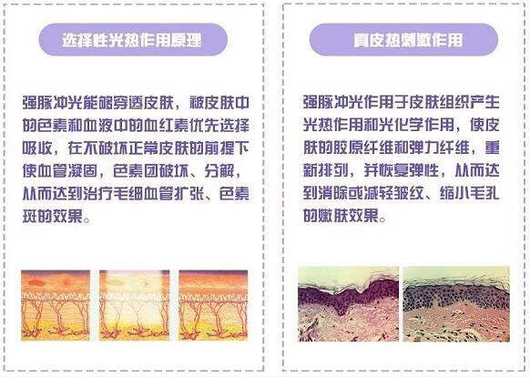 雀斑