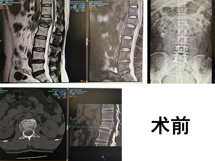 骨科机器人