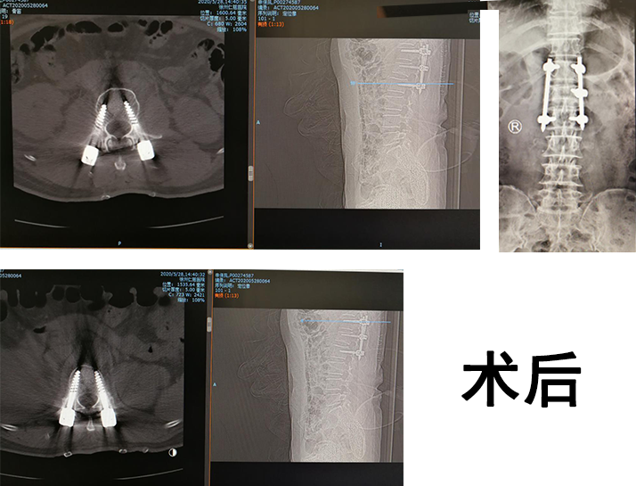 骨科机器人