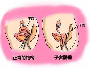 预约手术