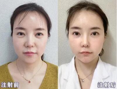 潘玮柏妻子