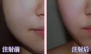 潘玮柏妻子