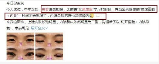 话痨景甜