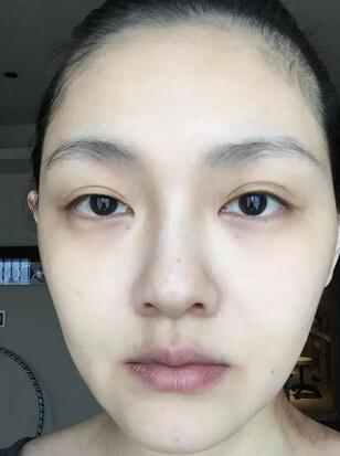 汪小菲