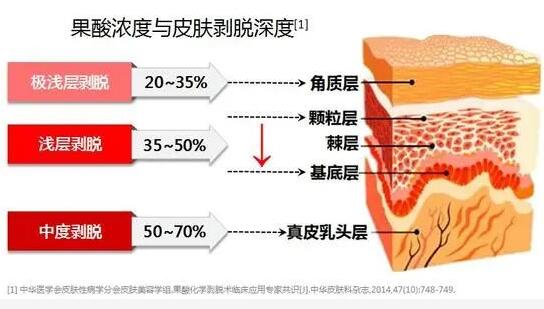 黑头
