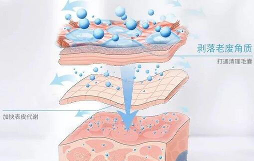 黑头