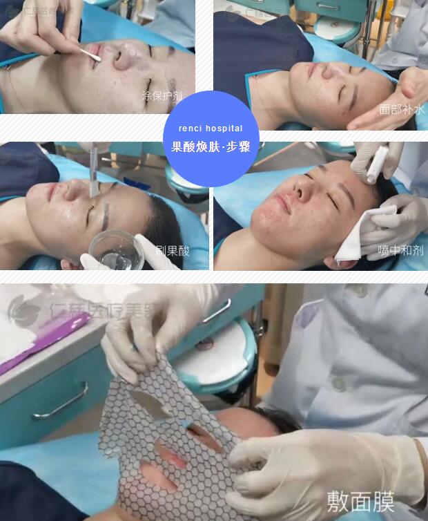 黑头