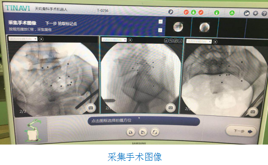 骨科机器人