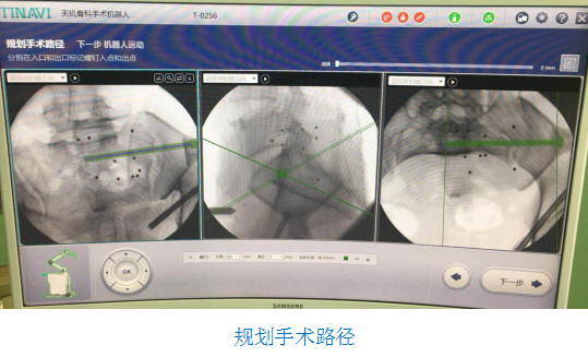 骨科机器人