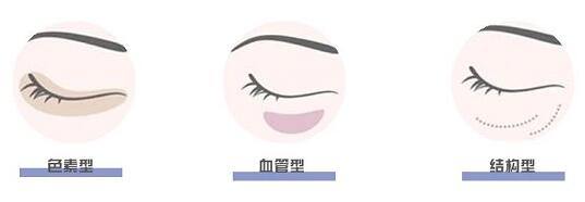 黑眼圈