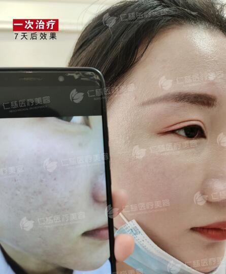 蔡依林