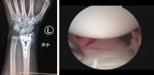 仁慈医院手外科