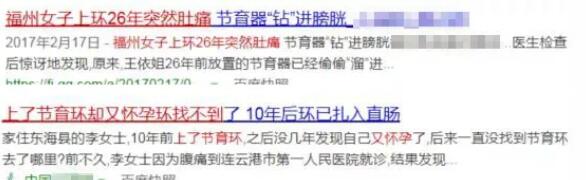 节育环