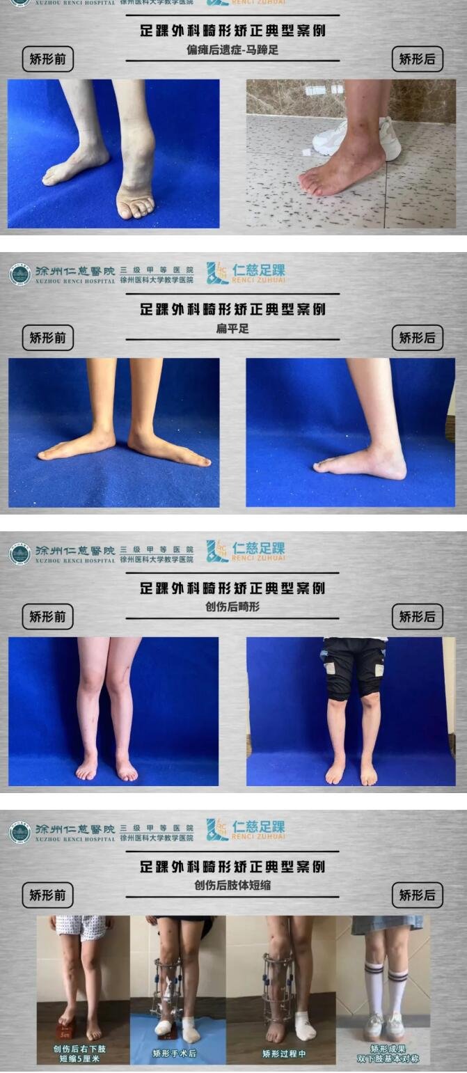 徐州仁慈医院